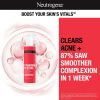 Neutrogena Stubborn Texture Daily Acne Facial Cleanser, 6.3 fl. oz